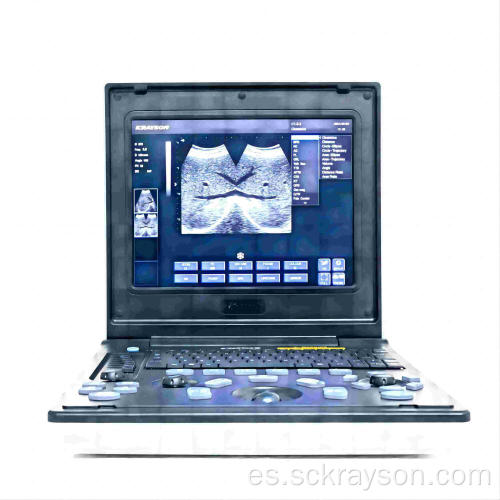 Instrumento de diagnóstico de ultrasonido de cálculos biliares femeninos